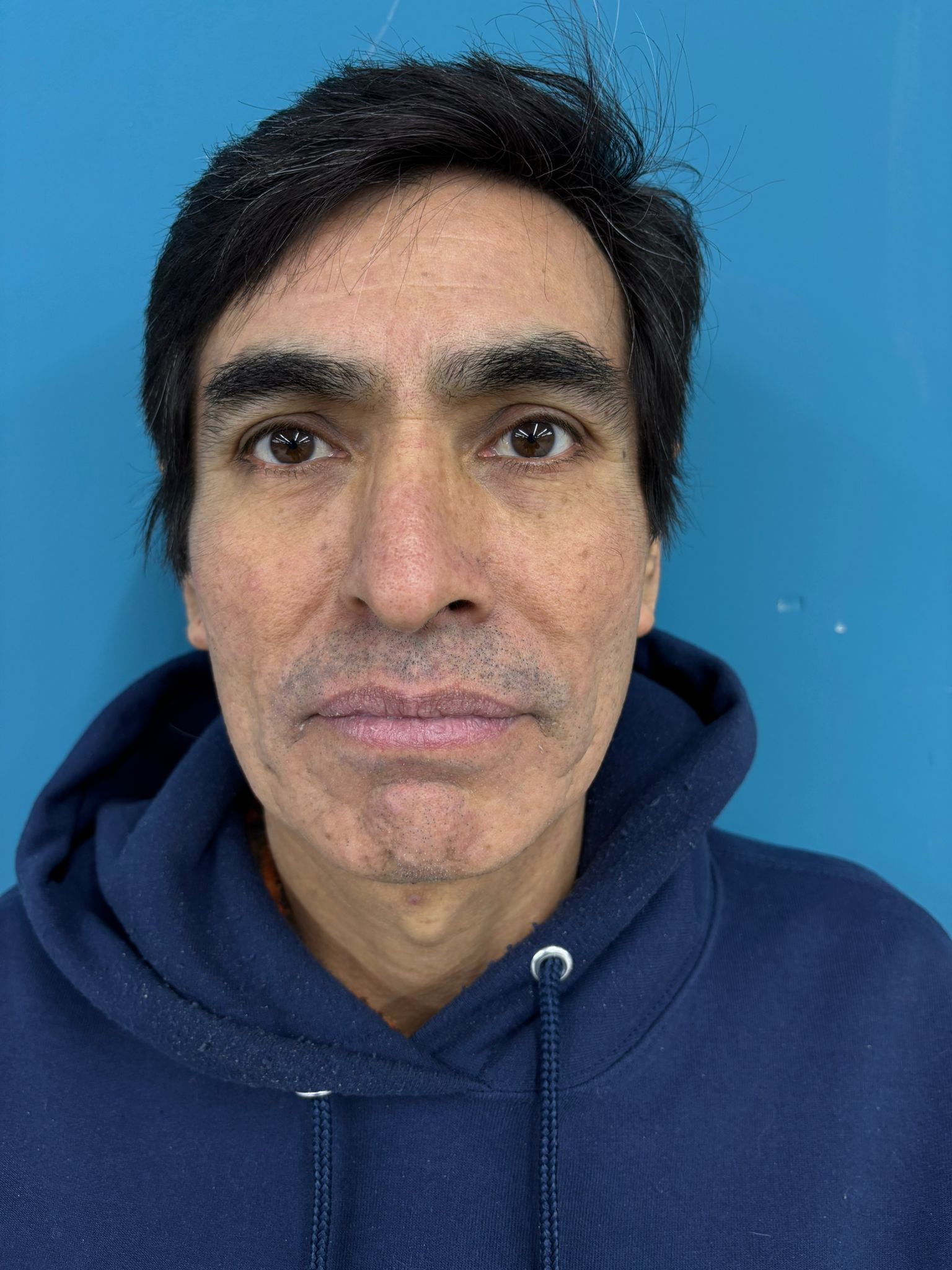 LUIS ARCE